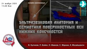 УЗИ анатомия и семиотика поверхностных вен нижних конечностей