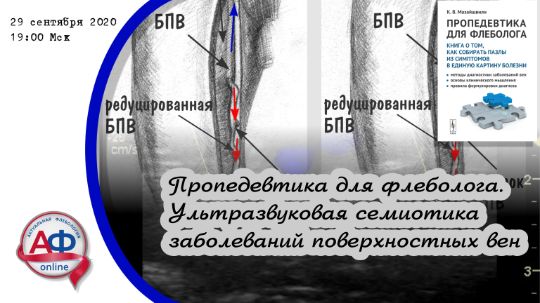 Ультразвуковая анатомия и семиотика заболеваний поверхностной венозной сети нижних конечностей