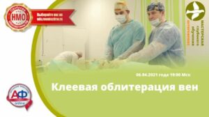 Клеевая облитерация вен