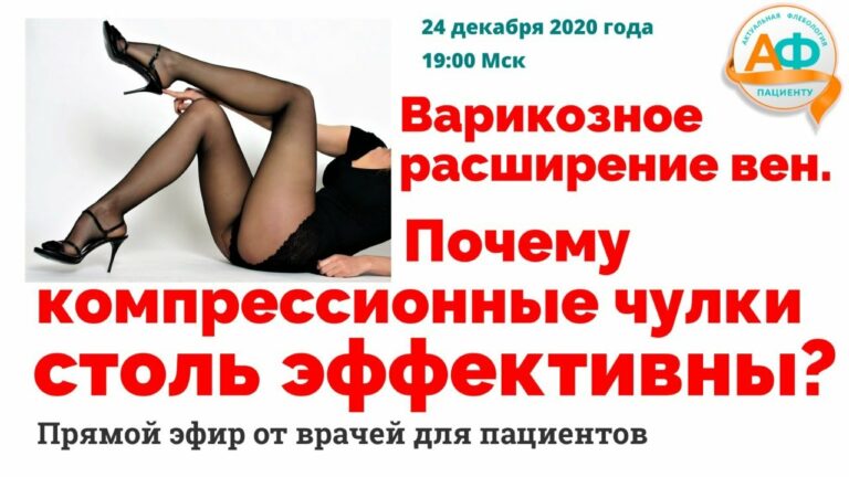 Почему компрессионные чулки столь эффективны при варикозе?