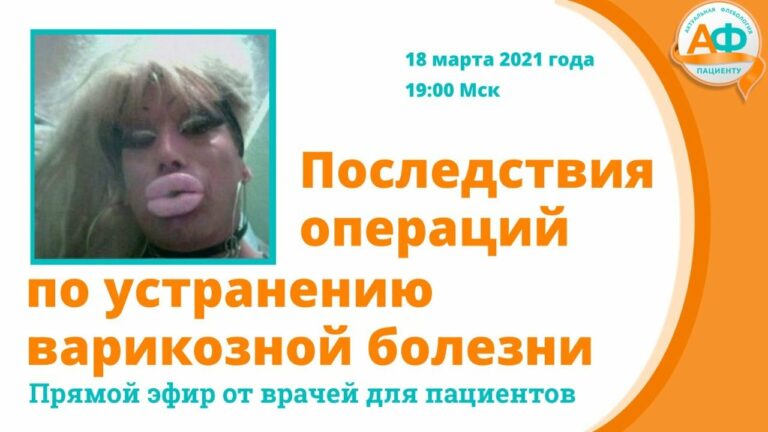 Варикоз после операции: как избежать рецидив болезни?