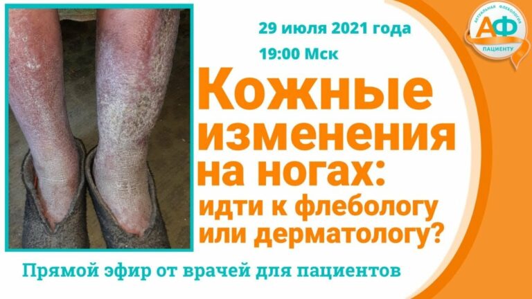 Кожные изменения на ногах: идти к флебологу или дерматологу?
