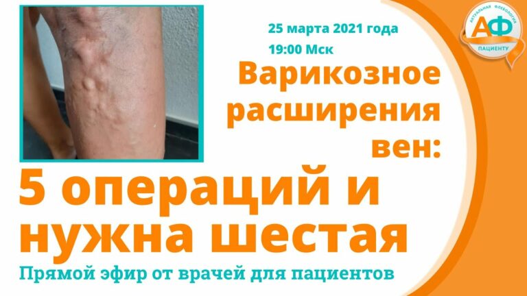 Медицинский детектив: что делать, если многочисленные операции при варикозе не помогают