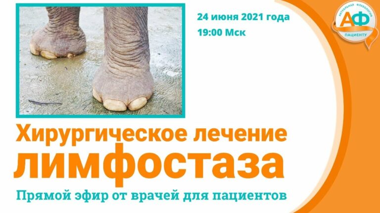 Хирургическое лечение лимфостаза