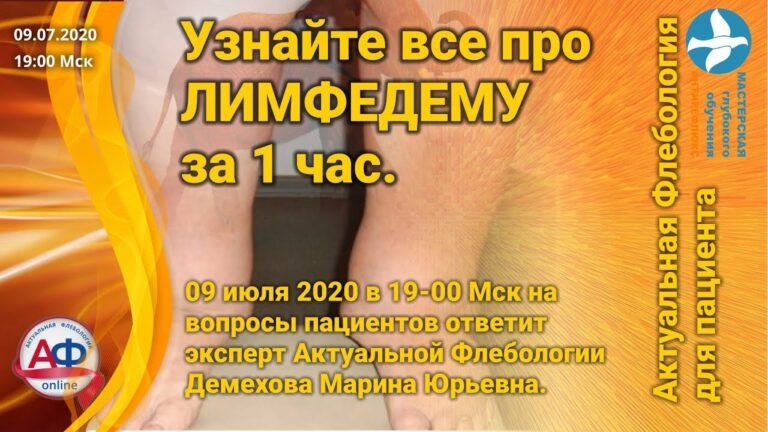 Пациентам о лимфедеме