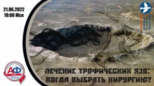 Лечение трофических язв: когда выбрать хирургию? - Актуальная Флебология