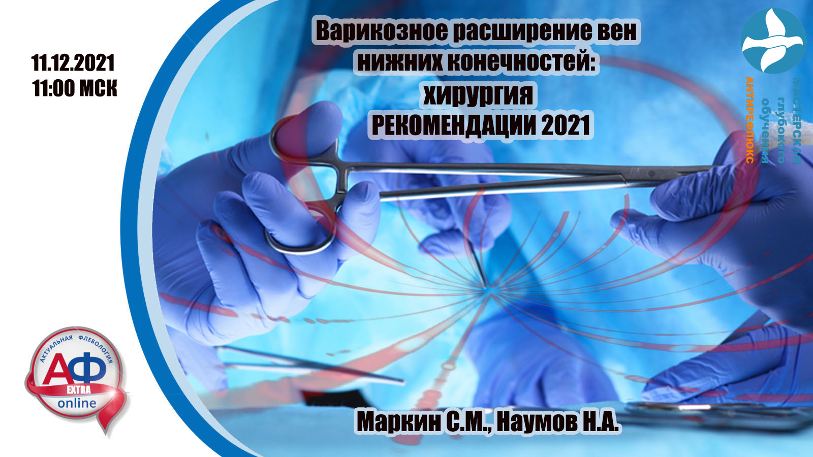 Варикозное расширение вен нижних конечностей: хирургическое лечение.  РЕКОМЕНДАЦИИ 2021.