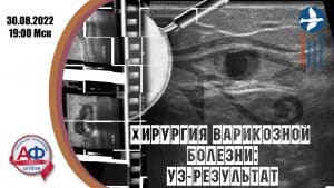 Хирургия варикозной болезни: УЗ-результат - Актуальная Флебология