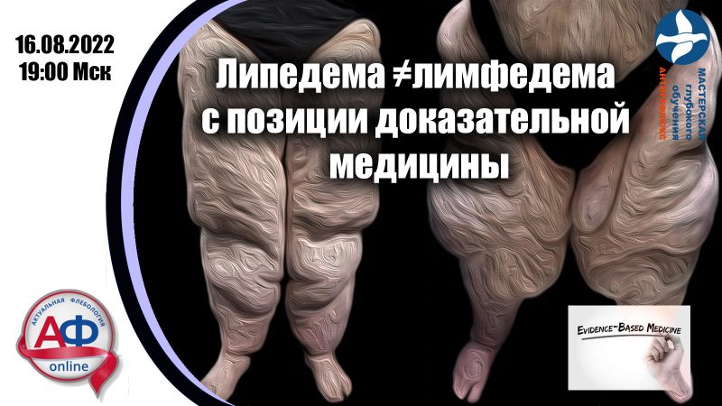 Липедема не равно лимфедема с позиций ЕВМ