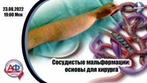 Сосудистые мальформации: основы для хирурга - Актуальная Флебология