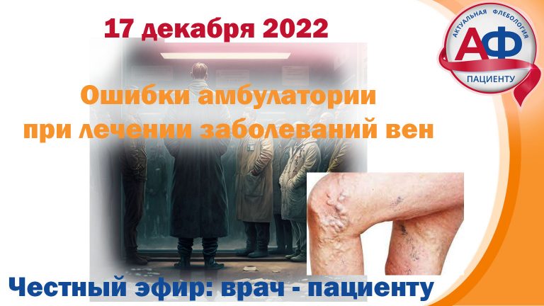 Ошибки врачей в поликлинике при лечении заболеваний вен