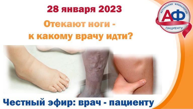 К какому врачу идти, если отекают ноги