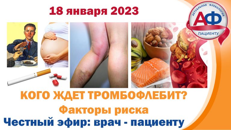 Кого ждет тромбофлебит — факторы риска