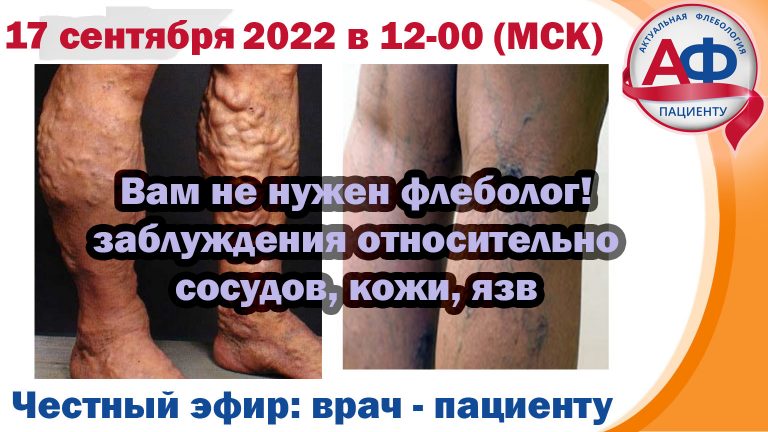 Когда вам нужен не флеболог: часть 2