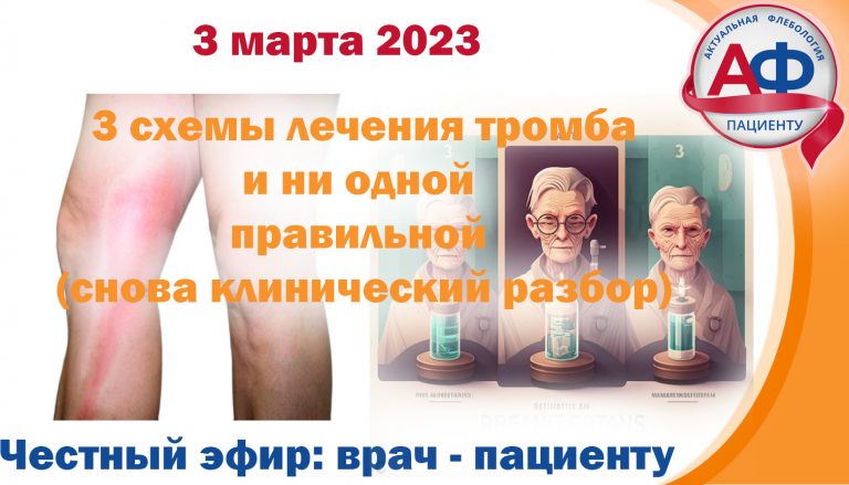 3 схемы лечения тромбоза и ни одной правильной: клинического случай для пациентов