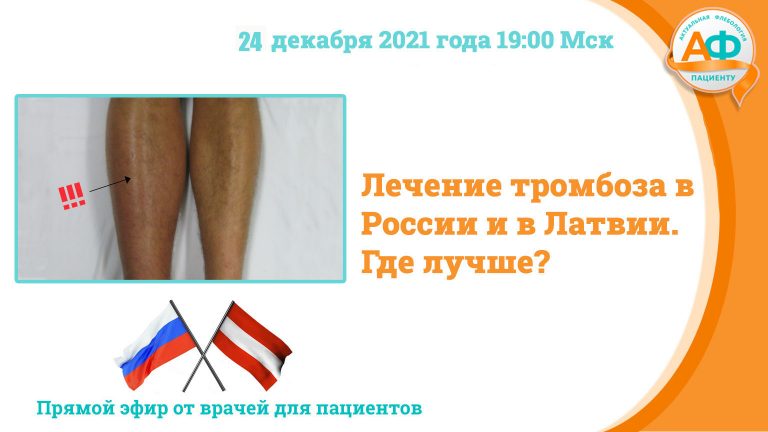 Лечение тромбоза в Латвии и России. Где лучше?