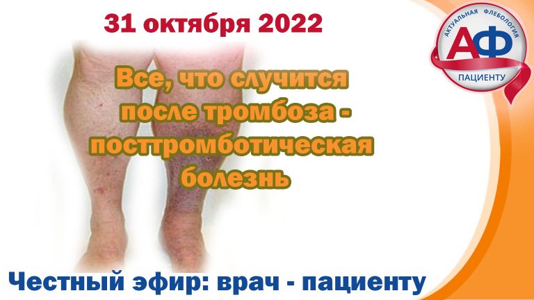Что происходит после тромбоза глубоких вен
