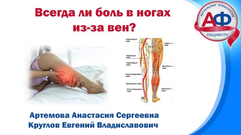 Причины боли в ногах — не удивляйтесь