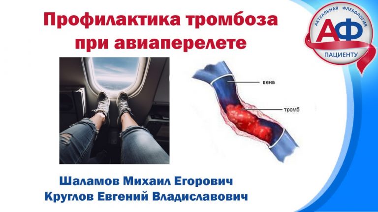 Как избежать тромбоза при авиаперелете?