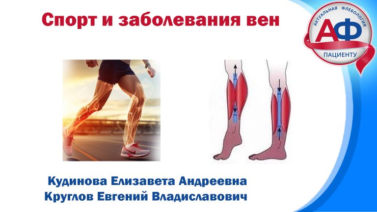 Спорт и болезни вен