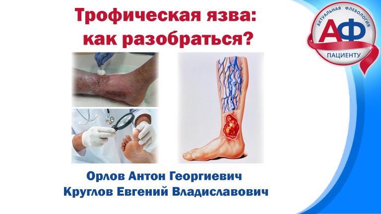 Трофическая язва: как с ней разобраться?