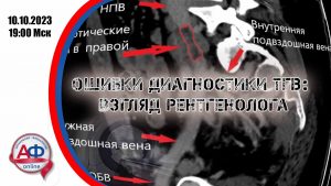 Ошибки диагностики тромбоза глубоких вен: взгляд рентгенолога - Актуальная Флебология