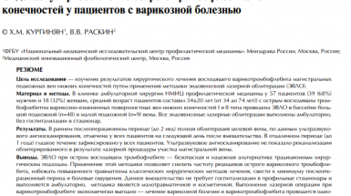 Эндоваскулярное лечение острого тромбофлебита вен нижних конечностей у пациентов с варикозной болезнью