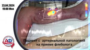 Пациент с артериальной патологией на приеме флеболога - Актуальная Флебология