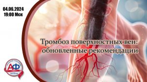 Тромбоз поверхностных вен, обновленные рекомендации - Актуальная Флебология
