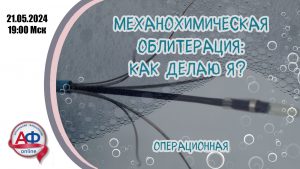 Механохимическая облитерация: как делаю я? Операционная - Актуальная Флебология