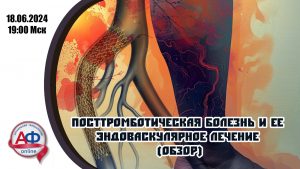 Посттромботическая болезнь и ее эндоваскулярное лечение (обзор) - Актуальная Флебология