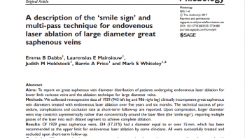Описание «симптома улыбки» и многопроходной техники эндовенозной лазерной абляции БПВ большого диаметра