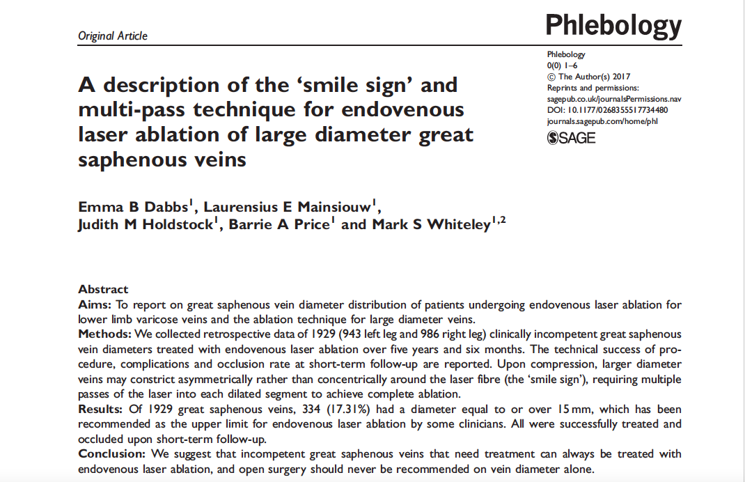 Описание «симптома улыбки» и многопроходной техники эндовенозной лазерной абляции БПВ большого диаметра