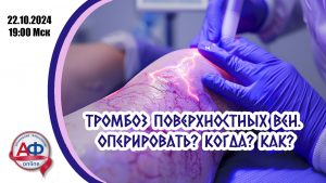 Тромбоз поверхностных вен. Оперировать? Когда? Как? - Актуальная Флебология