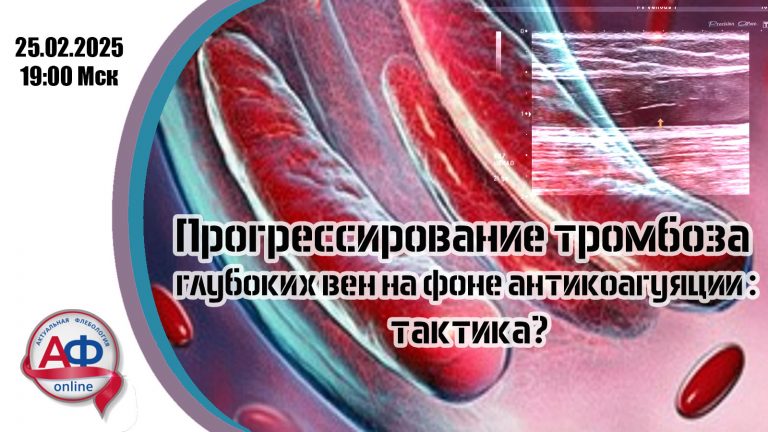 Прогрессирование тромбоза глубоких вен на фоне антикоагуляции: тактика?