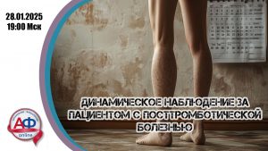 Динамическое наблюдение за  пациентом с посттромботической болезнью - Актуальная Флебология