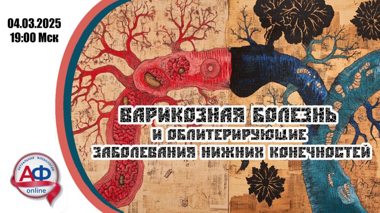 Варикозная болезнь и облитерирующие заболевания нижних конечностей