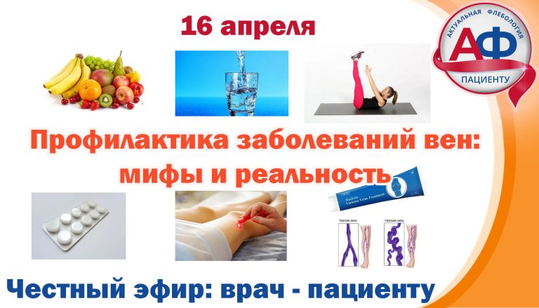 Профилактика заболеваний вен: мифы и реальность