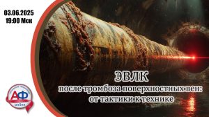 ЭВЛК после тромбоза поверхностных вен: от тактики к технике - Актуальная Флебология