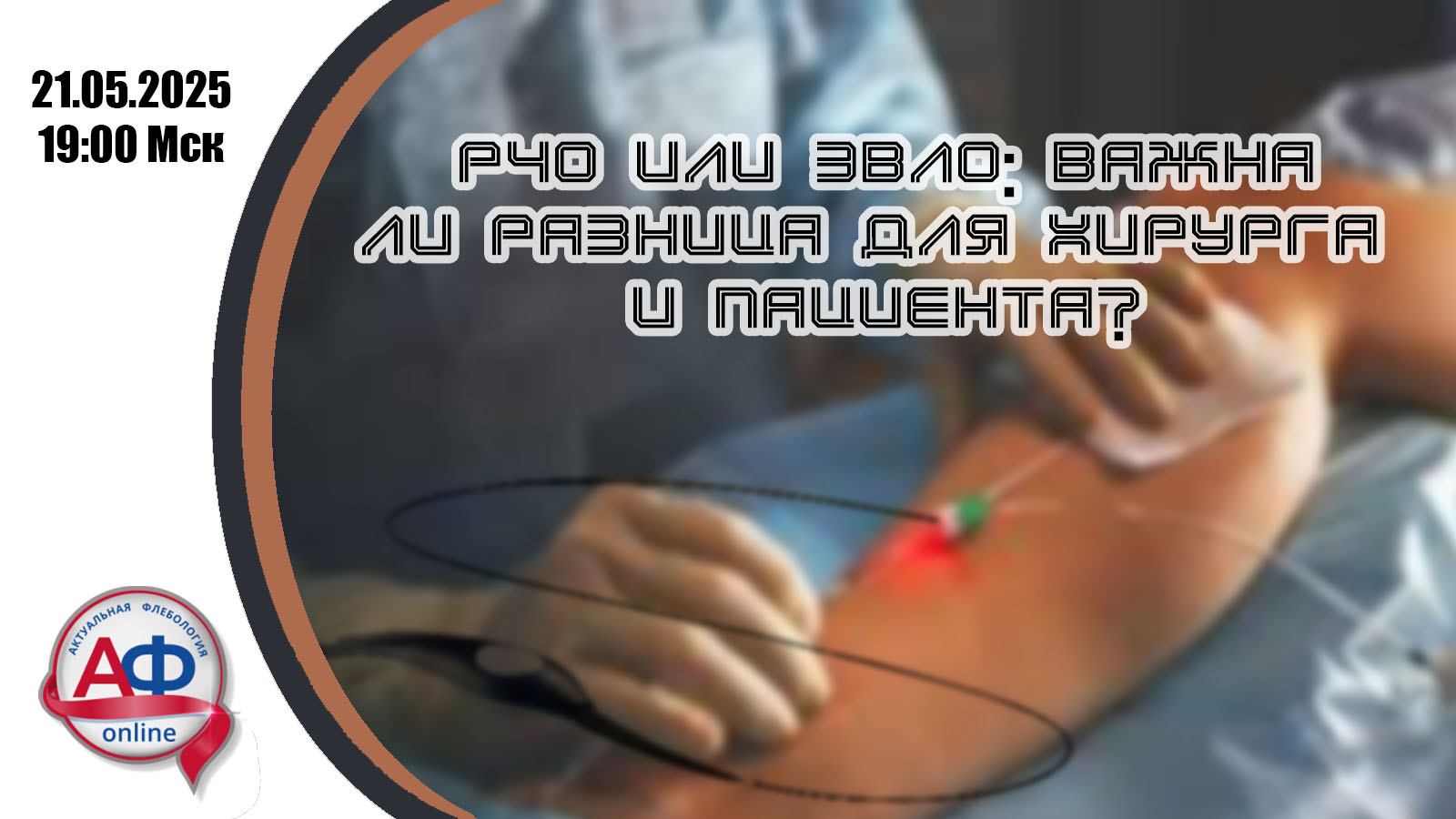 РЧО или ЭВЛО: важна ли разница для хирурга и пациента?
