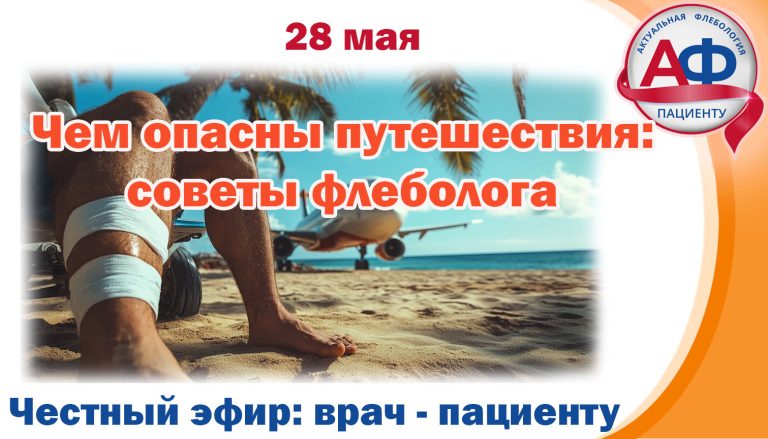 Чем опасны путешествия: советы флеболога
