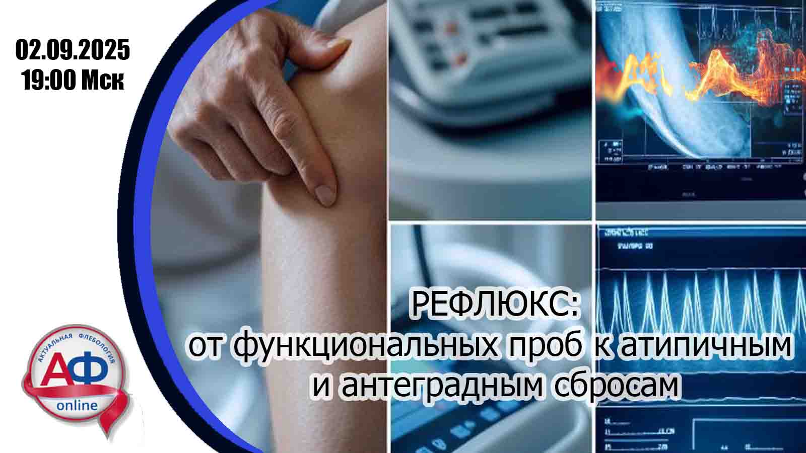 Рефлюкс: от функциональных проб к атипичным и антеградным сбросам