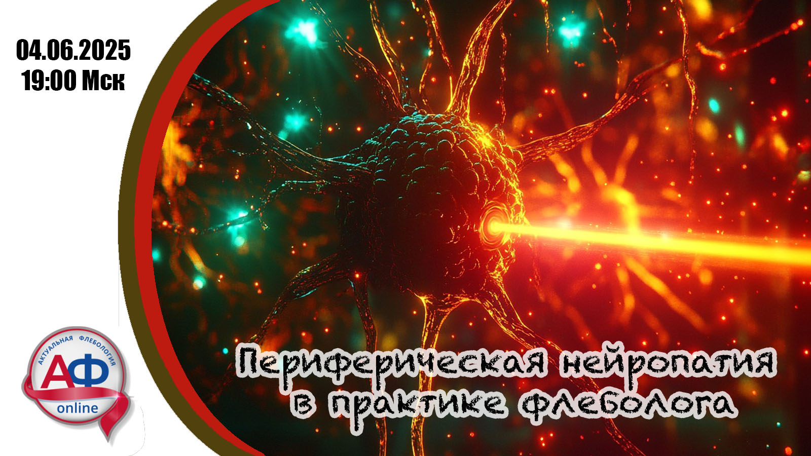 Периферическая нейропатия и невралгия: зоны ответственности невролога и флеболога