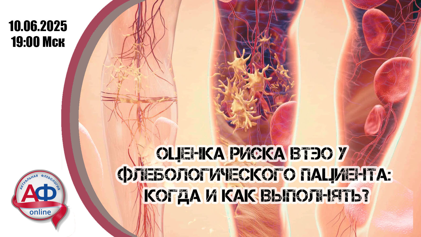 Оценка риска ВТЭО у флебологического пациента: когда и как выполнять?