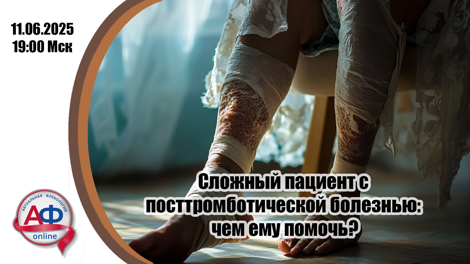 Сложный пациент с  посттромботической болезнью:  чем ему помочь?
