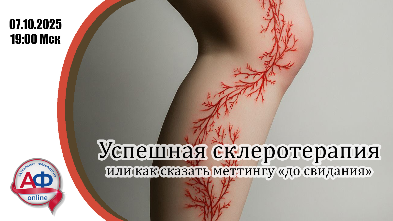 Изображение мероприятия Успешная склеротерапия или как сказать меттингу «до свидания» Успешная склеротерапия или как сказать меттингу «до свидания»