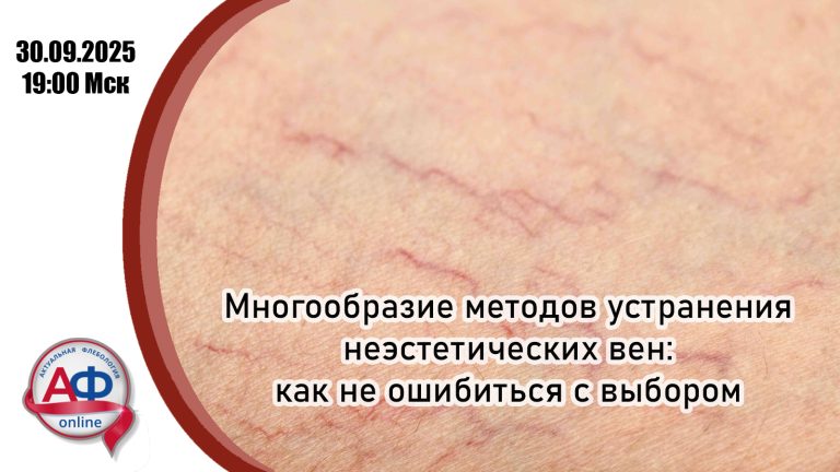 Многообразие методов устранения неэстетичных вен: как не ошибиться с выбором?