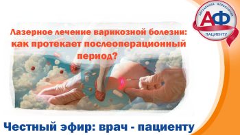 Лазерное лечение варикозной болезни: как протекает послеоперационный период?