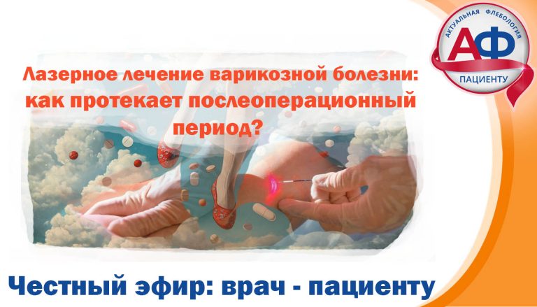 Лазерное лечение варикозной болезни: как протекает послеоперационный период?
