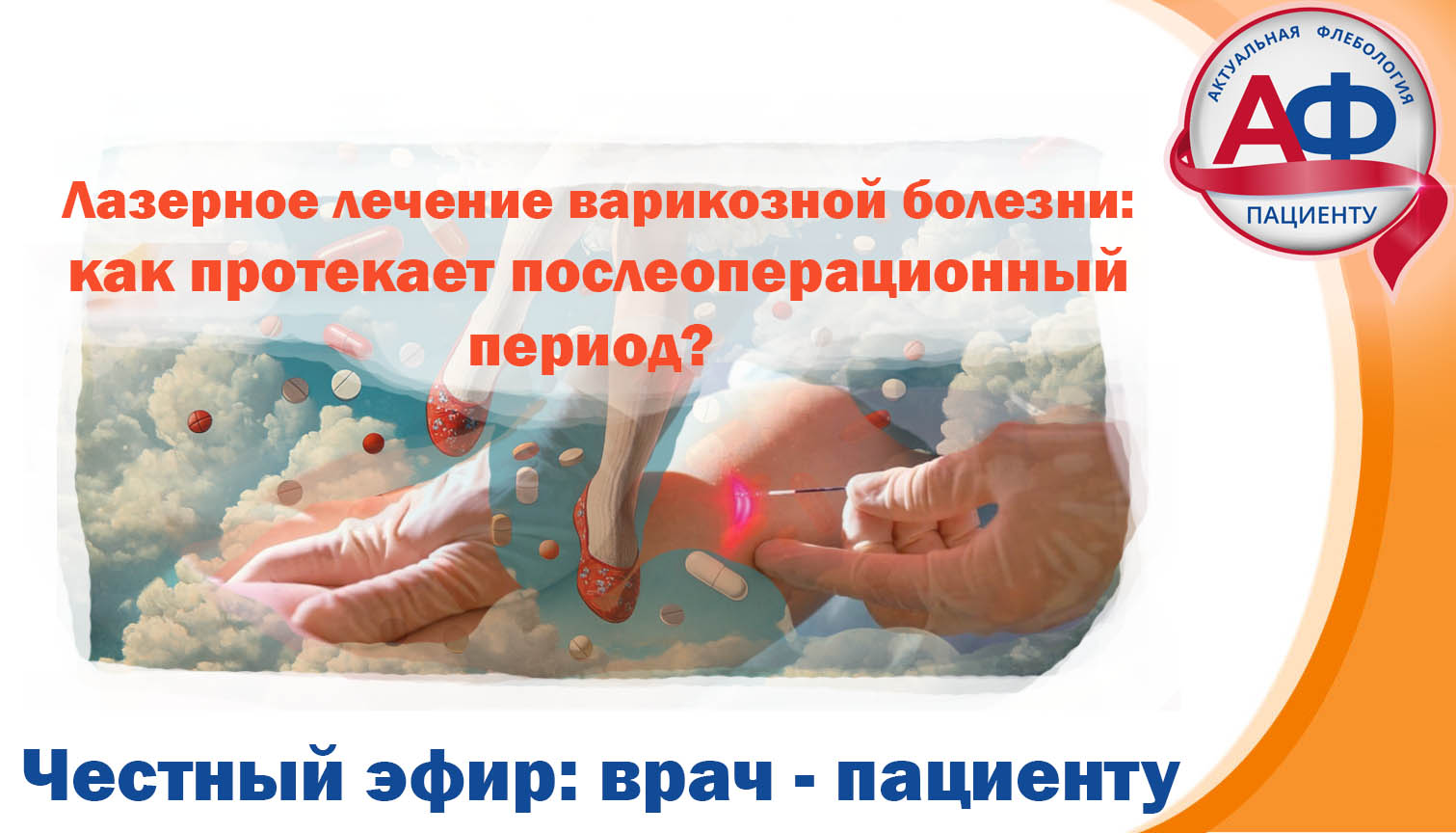 Статья - Лазерное лечение варикозной болезни: как протекает послеоперационный период?